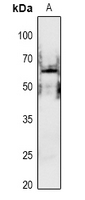 WB - Anti-PAK1 (pS199) Antibody AP61080